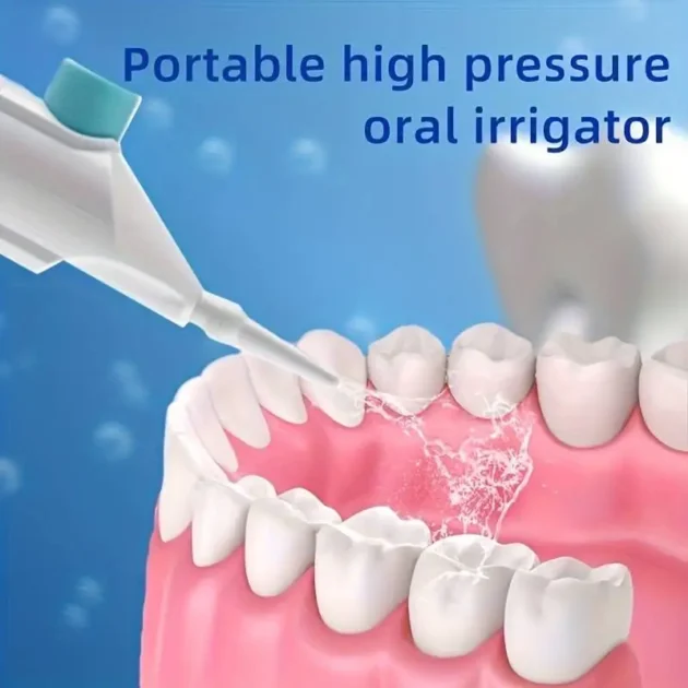 Portable High-Pressure Oral Irrigator for Teeth Cleaning - Image 2